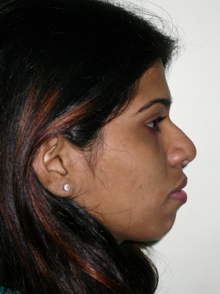 Before image